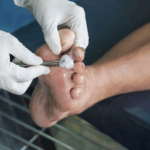 diavitiko podi ti einai