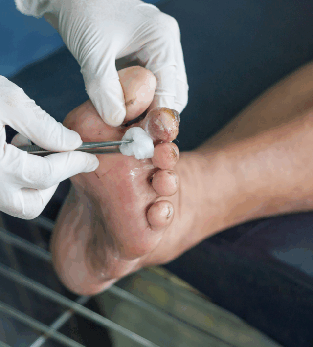 diavitiko podi ti einai