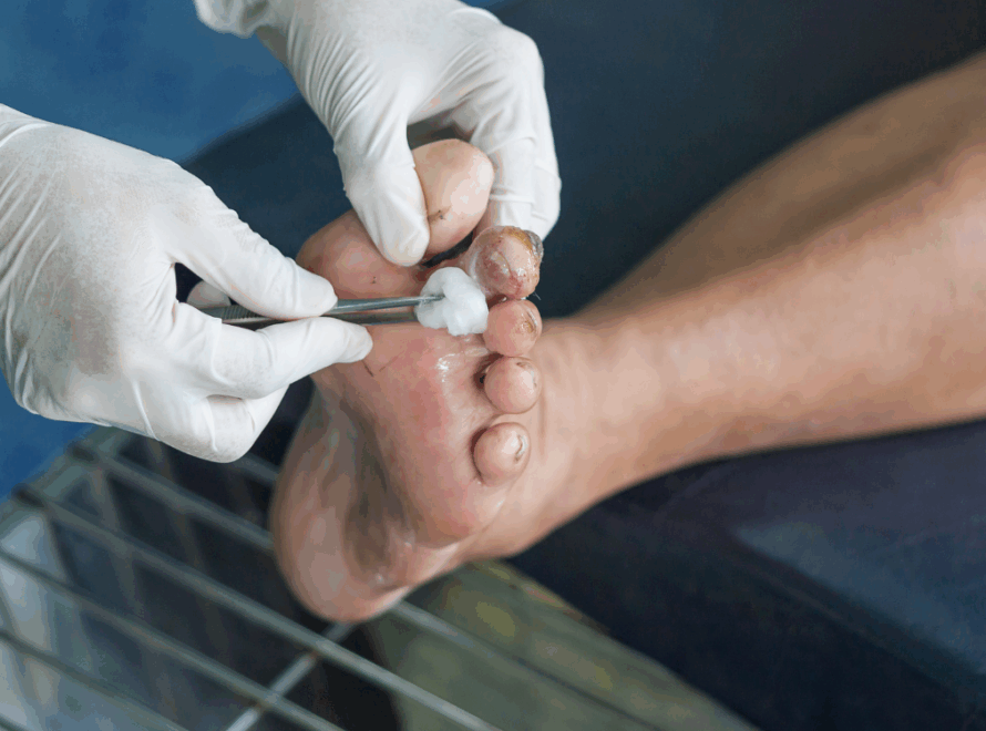 diavitiko podi ti einai