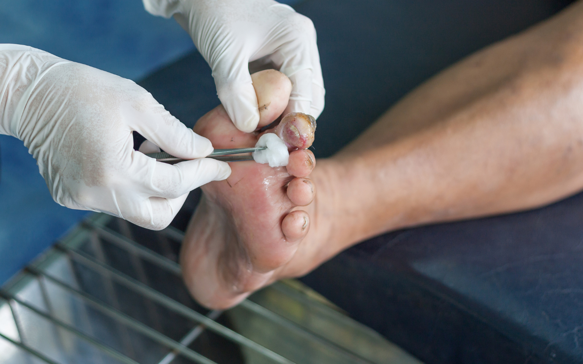 diavitiko podi ti einai