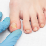 onixokriptosi tropoi apofigis