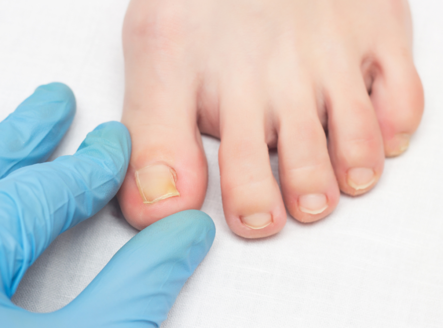 onixokriptosi tropoi apofigis