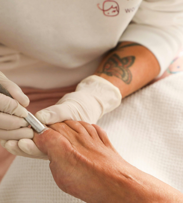 Χημικό έγκαυμα στα νύχια: Τι είναι και πώς αντιμετωπίζεται; ximiko egauma nixia pentikiour