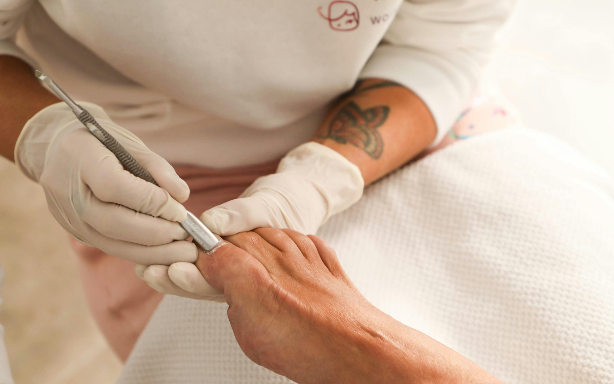 Χημικό έγκαυμα στα νύχια: Τι είναι και πώς αντιμετωπίζεται; ximiko egauma nixia pentikiour