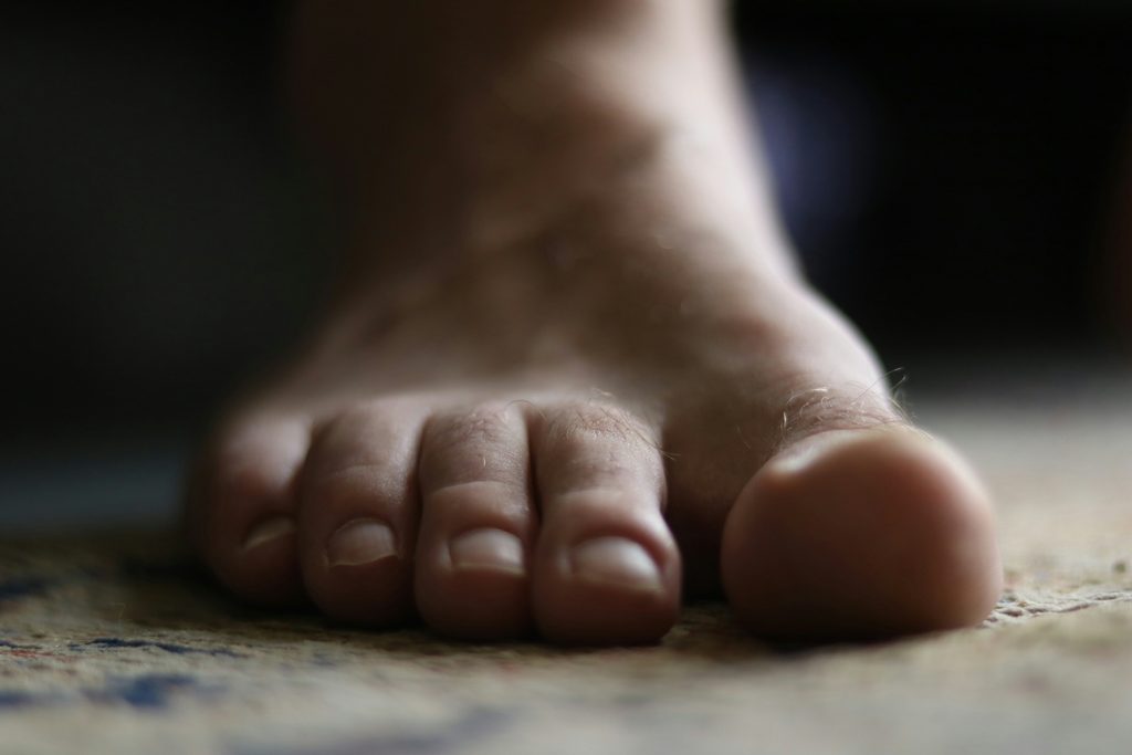Ποια είναι η κατάλληλη θεραπεία για την ονυχογρύπωση; antriki patousa